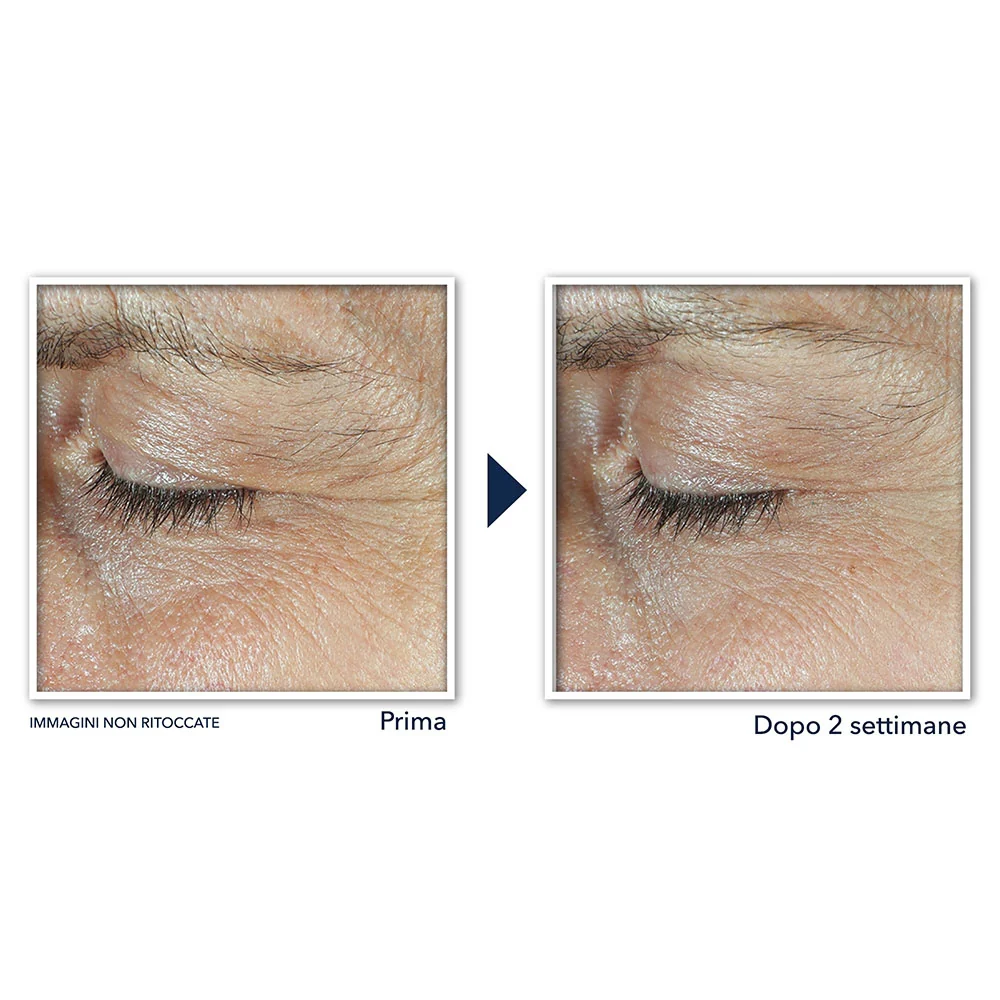 Roc Derm Correxion Soin Duo Contour Des Yeux 2 x 10 ml - Image 4