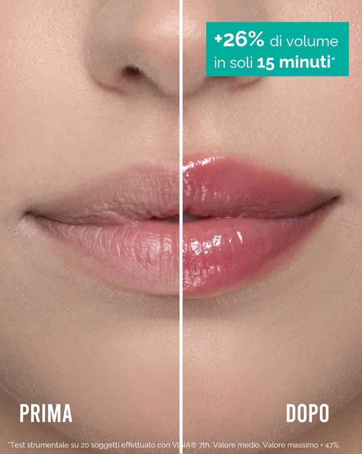 Mulac Lip Ceo - Image 4