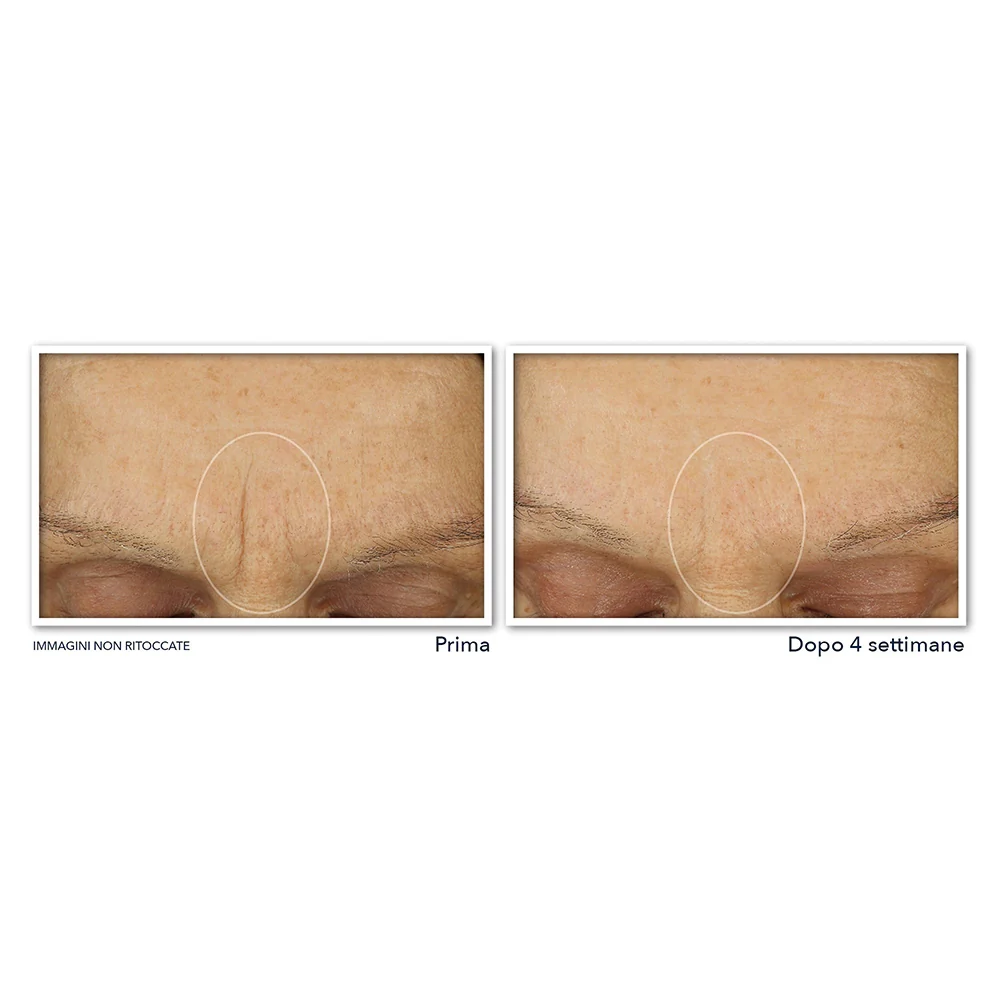 Roc Retinol Correxion Soin Lissant Crème Hydratation Maximale 50 ml - Image 4