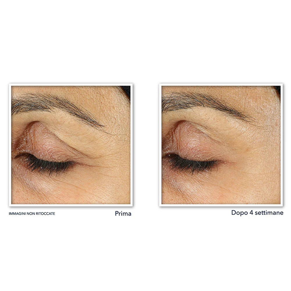 Roc Retinol Correxion Soin Lissant Crème Yeux 15 ml - Image 4